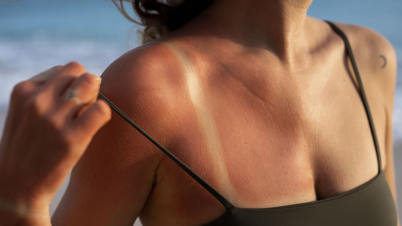 danos-provocados-pela-radiacao-uv danos-provocados-pela-radiacao-uv